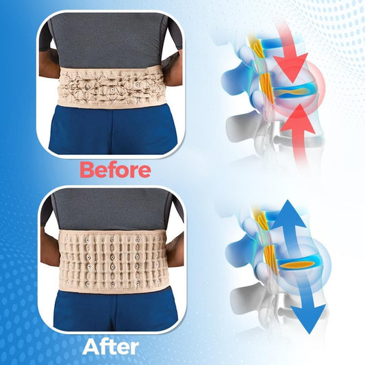 DeFlair® Pain Relief Decompression Belt ( ONLY TOODAY!! - BUY 1 GET 1 FREE)